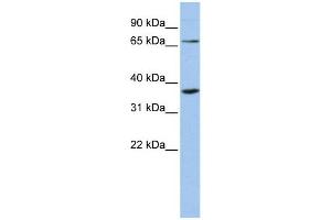 WB Suggested Anti-ZNF274  Antibody Titration: 0. (ZNF274 抗体  (Middle Region))