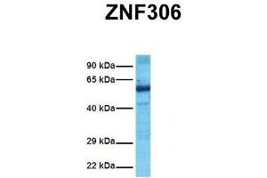 Host:  Rabbit  Target Name:  ZNF306  Sample Tissue:  Human Ovary Tumor  Antibody Dilution:  1. (ZKSCAN3 抗体  (N-Term))