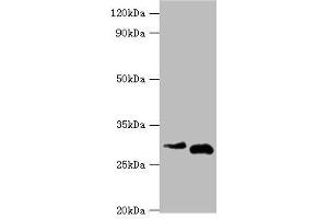 Western blot All lanes: Cerberus antibody at 2 μg/mL Lane 1: Hela whole cell lysate Lane 2: Rat kidney tissue Secondary Goat polyclonal to rabbit IgG at 1/10000 dilution Predicted band size: 30 kDa Observed band size: 30 kDa (CER1 抗体  (AA 18-267))