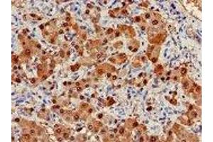 Immunohistochemistry (IHC) image for anti-Arginase, Liver (ARG1) (AA 1-322) antibody (ABIN6091459) (Liver Arginase 抗体  (AA 1-322))