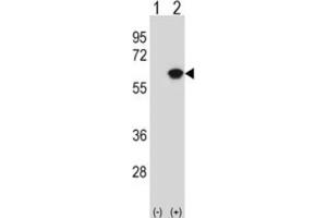 Western Blotting (WB) image for anti-Nucleosome Assembly Protein 1-Like 1 (NAP1L1) antibody (ABIN3000776) (NAP1L1 抗体)