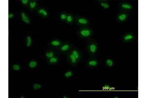 Image no. 3 for anti-TATA Box Binding Protein Associated Factor 11 (TAF11) (AA 158-211) antibody (ABIN598956) (TAF11 抗体  (AA 158-211))