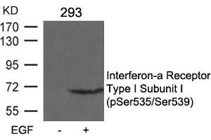 Western blot analysis of extracts from 293 cells untreated or treated with EGF using Interferon-a Receptor Type I Subunit I (phospho-Ser535/Ser539) Antibody. (IFNAR1 抗体  (pSer535, pSer539))