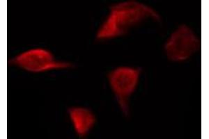 ABIN6267231 staining HepG2 by IF/ICC. (IKK alpha 抗体  (pSer176, pSer177))