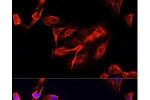 Immunofluorescence analysis of U-2 OS cells using CLUH Polyclonal Antibody at dilution of 1:100 (40x lens). (CLUH 抗体)