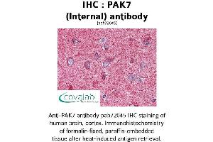 Image no. 1 for anti-P21 Protein (Cdc42/Rac)-Activated Kinase 7 (PAK7) (Internal Region) antibody (ABIN1737840) (PAK7 抗体  (Internal Region))