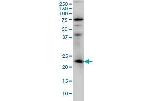 RAB3A monoclonal antibody (M01), clone 4H7 Western Blot analysis of RAB3A expression in IMR-32 . (RAB3A 抗体  (AA 122-220))