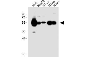 All lanes : Anti-ALDH1A1 Antibody (Center) at 1:1000 dilution Lane 1: A549 whole cell lysate Lane 2: HepG2 whole cell lysate Lane 3: HT-29 whole cell lysate Lane 4: Mouse lung lysate Lane 5: Mouse liver lysate Lysates/proteins at 20 μg per lane. (ALDH1A1 抗体  (AA 306-339))