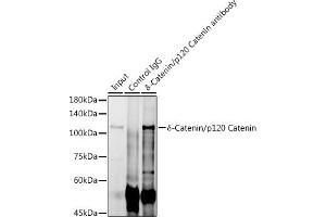Immunoprecipitation (IP) image for anti-Catenin (Cadherin-Associated Protein), delta 1 (CTNND1) antibody (ABIN7266144)