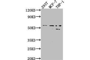 Western Blot Positive WB detected in: 293T whole cell lysate, MCF-7 whole cell lysate, THP-1 whole cell lysate All lanes: MMP12 antibody at 1:1000 Secondary Goat polyclonal to rabbit IgG at 1/50000 dilution Predicted band size: 55 kDa Observed band size: 54, 45 kDa (Recombinant MMP12 抗体)
