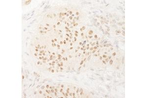 Immunohistochemistry (IHC) image for anti-Kinesin Family Member C1 (KIFC1) (AA 625-673) antibody (ABIN7453563)