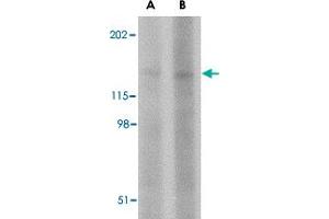 Western blot analysis of BAIAP3 in SK-N-SH cell lysate with BAIAP3 polyclonal antibody  at (A) 1 and (B) 2 ug/mL . (BAIAP3 抗体  (N-Term))