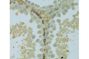 Immunohistochemistry of paraffin-embedded Rat testis using KCNJ1 Polyclonal Antibody at dilution of 1:100 (40x lens). (KCNJ1 抗体)