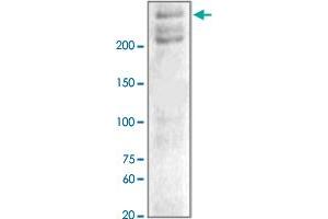 The tissue lysates derived from hypoxic mouse brain were immunoblotted by NF1 polyclonal antibody  at 1 : 1000. (Neurofibromin 1 抗体  (C-Term))