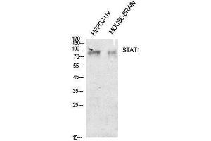 Western Blotting (WB) image for anti-Signal Transducer and Activator of Transcription 1, 91kDa (STAT1) (Internal Region) antibody (ABIN3188009) (STAT1 抗体  (Internal Region))