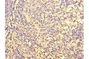 Immunohistochemistry of paraffin-embedded human tonsil tissue using ABIN7153123 at dilution of 1:100 (FOSL2 抗体  (AA 1-326))
