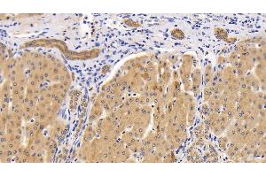 Detection of SQSTM1 in Human Liver Tissue using Polyclonal Antibody to Sequestosome 1 (SQSTM1)