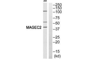 Western Blotting (WB) image for anti-Melanoma Antigen Family C, 2 (MAGEC2) (Internal Region) antibody (ABIN1852688) (MAGEC2 抗体  (Internal Region))