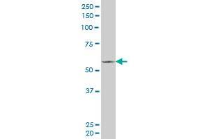 FLI1 monoclonal antibody (M02), clone 2G8. (FLI1 抗体  (AA 1-452))