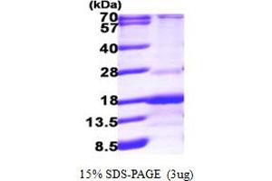 RAB Interacting Factor (RABIF) (AA 1-123) protein (His tag)