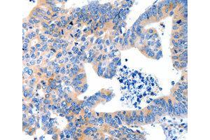 Immunohistochemistry (IHC) image for anti-Low Density Lipoprotein Receptor-Related Protein Associated Protein 1 (LRPAP1) antibody (ABIN1873566) (LRPAP1 抗体)