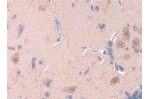 Detection of LEP in Rat Brain Tissue using Polyclonal Antibody to Leptin (LEP) (Leptin 抗体  (AA 22-167))