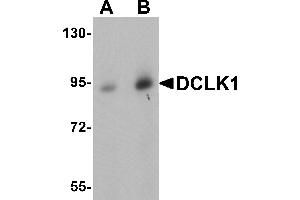 Western Blotting (WB) image for anti-Doublecortin-Like Kinase 1 (DCLK1) (N-Term) antibody (ABIN1031345)