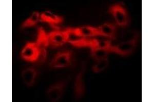 Immunofluorescent analysis of Tropomyosin staining in Hela cells. (Tropomyosin 抗体)