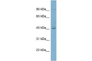 WB Suggested Anti-RFPL3 Antibody Titration: 0. (RFPL3 抗体  (Middle Region))