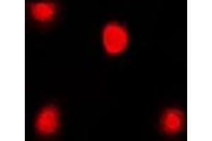 Immunofluorescent analysis of FKBP4 staining in Jurkat cells. (FKBP4 抗体)