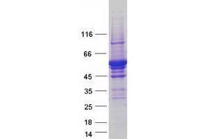 Western Blotting (WB) image for Tryptophan Hydroxylase 2 (TPH2) protein (Myc-DYKDDDDK Tag) (ABIN2734415)