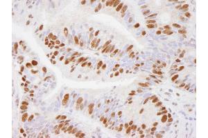 Immunohistochemistry (IHC) image for anti-Ubiquitin Specific Peptidase 7 (Herpes Virus-Associated) (USP7) (AA 1-50) antibody (ABIN7449033) (USP7 抗体  (AA 1-50))