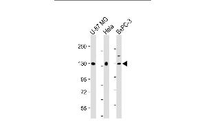 All lanes : Anti-MGEA5 Antibody (N-Term) at 1:2000 dilution Lane 1: U-87 MG whole cell lysate Lane 2: Hela whole cell lysate Lane 3: BxPC-3 whole cell lysate Lysates/proteins at 20 μg per lane. (MGEA5 抗体  (AA 236-269))