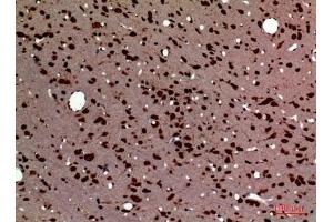 Immunohistochemical analysis of paraffin-embedded rat-brain, antibody was diluted at 1:100.