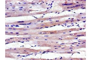 Immunohistochemistry of paraffin-embedded human heart tissue using ABIN7143036 at dilution of 1:100 (ABLIM1 抗体  (AA 174-319))