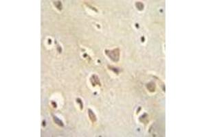 Immunohistochemistry analysis in formalin fixed and paraffin embedded human brain tissue reacted with MCHR1 / GPR24 Antibody (C-term) followed which was peroxidase conjugated to the secondary antibody and followed by DAB staining. (MCHR1 抗体  (C-Term))