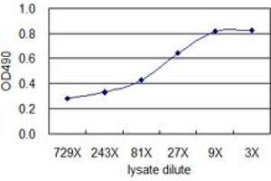 Standard curve using 293T overexpression lysate (non-denatured) as an analyte. (B2M (人) Matched Antibody Pair)
