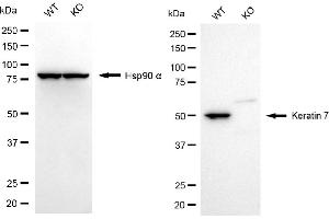 Western blotting analysis using keratin 7 antibody (ABIN7799188).