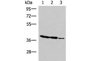 Western blot analysis of HT-29 K562 and HUVEC cell lysates using GIMAP2 Polyclonal Antibody at dilution of 1:1000 (GIMAP2 抗体)