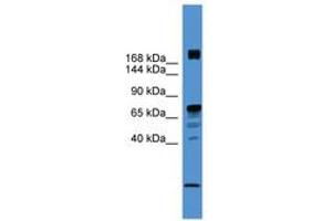 Image no. 1 for anti-Rearranged L-Myc Fusion (RLF) (AA 20-69) antibody (ABIN6745418) (RLF 抗体  (AA 20-69))