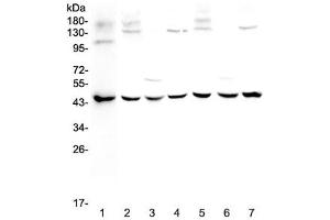 Western blot testing of 1) human MCF7, 2) rat brain, 3) rat kidney, 4) rat testis, 5) mouse brain, 6) mouse kidney and 7) mouse testis lysate with WWOX antibody at 0.