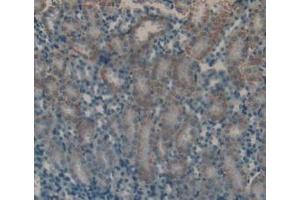 Detection of FSH in Mouse Kidney Tissue using Polyclonal Antibody to Follicle Stimulating Hormone (FSH) (FSH 抗体  (AA 25-120))