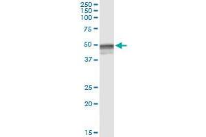 Immunoprecipitation of HYAL3 transfected lysate using anti-HYAL3 MaxPab rabbit polyclonal antibody and Protein A Magnetic Bead , and immunoblotted with HYAL3 purified MaxPab mouse polyclonal antibody (B01P) . (HYAL3 抗体  (AA 1-417))