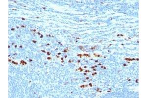 Formalin-fixed, paraffin-embedded human tonsil stained with MRP8 + MPR14 protein antibody (MAC387) (S100A8/A9 Complex (Calprotectin) 抗体)
