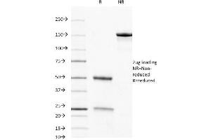 SDS-PAGE Analysis Purified CD8 Mouse Monoclonal Antibody (C8/468). (CD8 alpha 抗体)