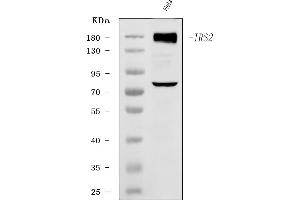 Western blot analysis of IRS2 using anti-IRS2 antibody (ABIN7601988).