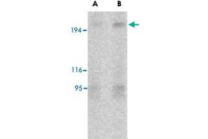 Western blot analysis of TSC2 in L1210 cell lysate with TSC2 polyclonal antibody  at (A) 2 and (B) 4 ug/mL . (Tuberin 抗体  (N-Term))