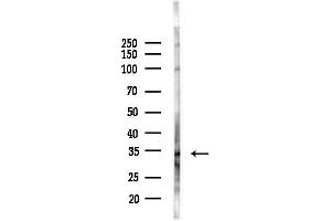 Western blot analysis of lysates from COLO205 cells(heat-shock,45 min treatment), using OR2 Antibody at 1/1000 dilution.