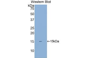 Western Blotting (WB) image for anti-Single Immunoglobulin and Toll-Interleukin 1 Receptor (TIR) Domain (SIGIRR) (AA 1-118) antibody (ABIN7437203)