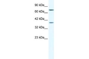 Human HepG2; WB Suggested Anti-ZNF660 Antibody Titration: 1. (ZNF660 抗体  (C-Term))